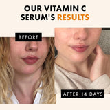 Brightening Vitamin C Serum