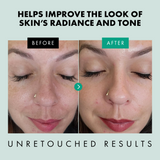 Niacinamide Serum for Face