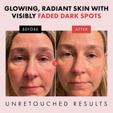 Renewing Retinol Serum for Face