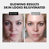 Eclat Skincare Face Serum Set – Vitamin C & Retinol Serum