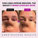 Collagen Anti Aging Face Cream with Patented Matrixyl-3000 & Argireline