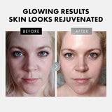 Face Serum Set – Vitamin C, Retinol, Hyaluronic Acid for Hydration & Anti-Aging