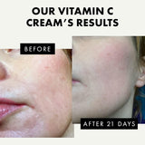 Vitamin C Moisturizer for Face with Hyaluronic Acid & Squalane