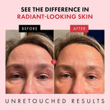 Retinol Night Cream – 2.5% Retinol & Hyaluronic Acid Face Moisturizer