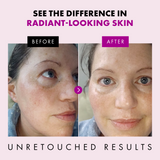 Collagen Anti Aging Face Cream with Patented Matrixyl-3000 & Argireline